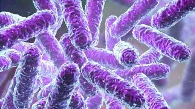 shigella shigella