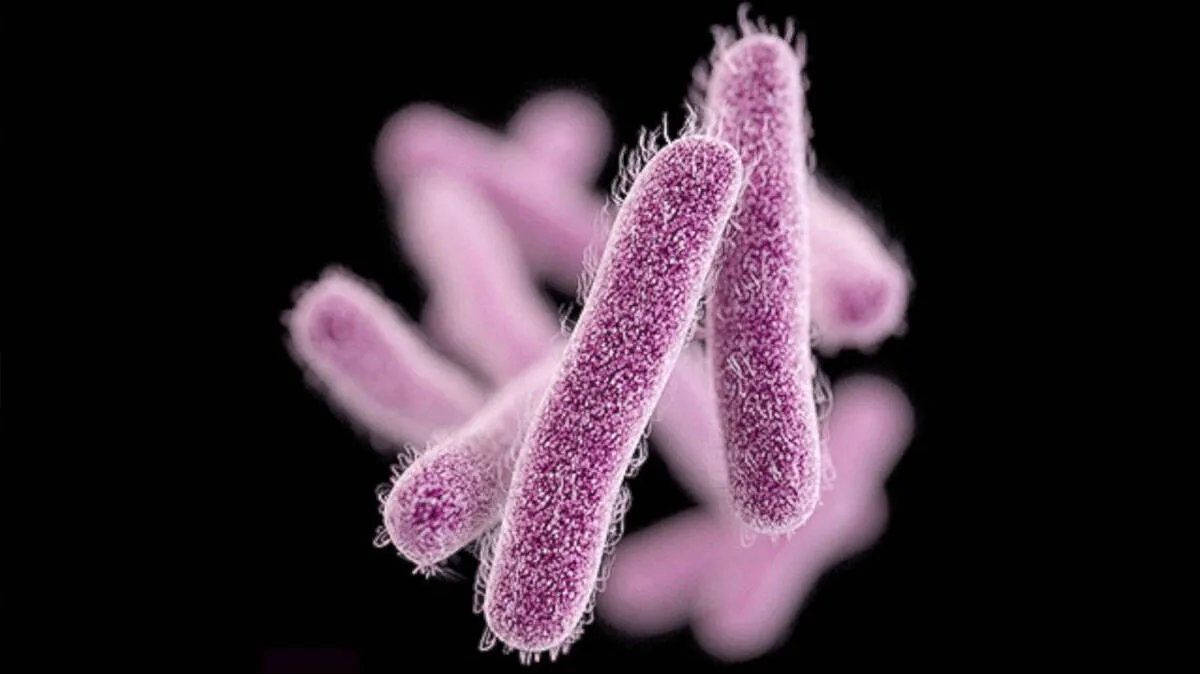 shigella shigella
