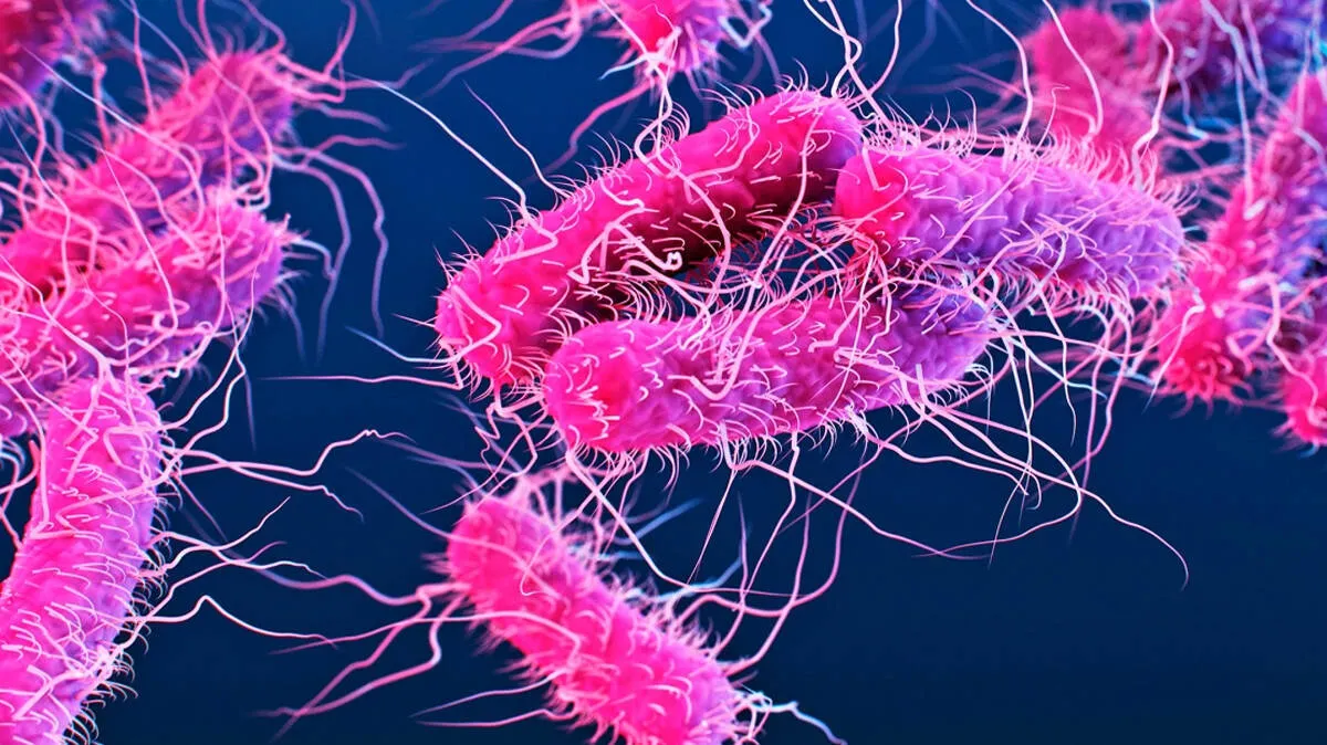 shigella shigella