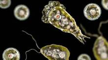 amoebic-infection