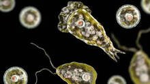 another-case-of-amoebic-m