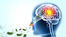 brain