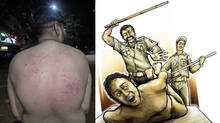 police-brutality