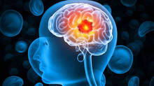 amoebic-meningoencephalit