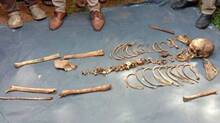 skeleton