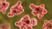 amoebic-death-