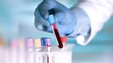 hiv-positive-kerala-