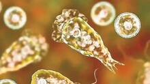 amoebic-infection