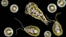 amoebic-encephalitis