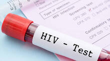 hiv
