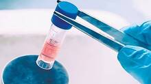 ivf