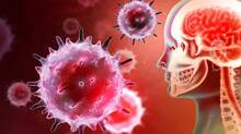 amoebic-encephalitis