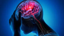 brain
